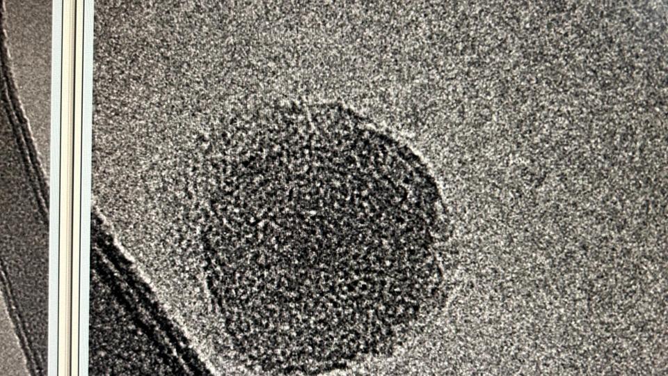 vesicula