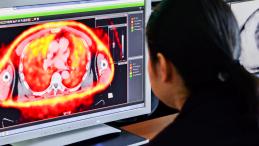 IAEA Training in 3-D Radiotherapy Tools