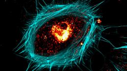 Confocal microscopy reveals the complexity of senescent cell morphology, vesicle localization and cytoskeletal rearrangements.