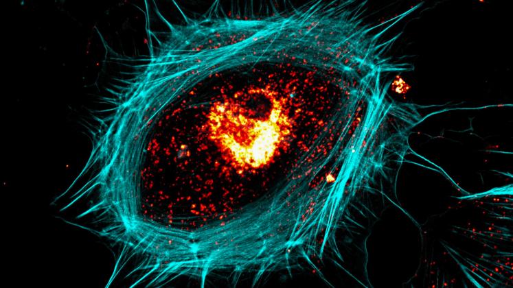 Confocal microscopy reveals the complexity of senescent cell morphology, vesicle localization and cytoskeletal rearrangements.